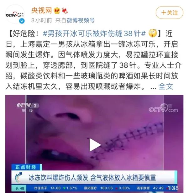38针！只因夏天在冰箱放了这些东西！k8凯发冰箱突然爆炸！6岁男孩脸缝